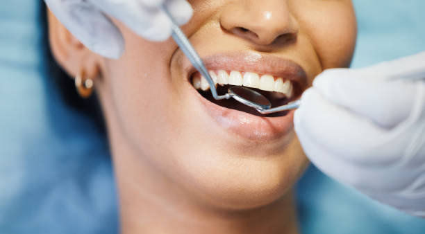 Best Emergency Wisdom Tooth Extraction in Shelby, MI